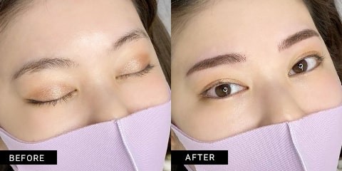 症例写真