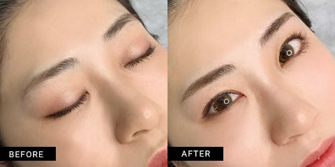 症例写真