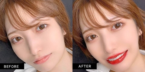 症例写真