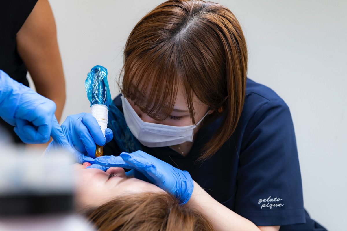 モニター施術