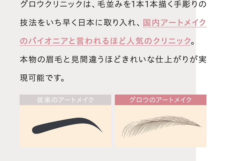 グロウクリニックは、毛並みを1本1本描く手彫りの技法をいち早く日本に取り入れ、国内アートメイクのパイオニアと言われるほど人気のクリニック。本物の眉毛と見間違うほどきれいな仕上がりが実現可能です。